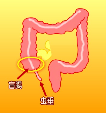 盲腸と虫垂