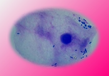 口内の微生物 グラム染色